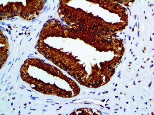 IHC of PSAP on an FFPE Prostate Tissue
